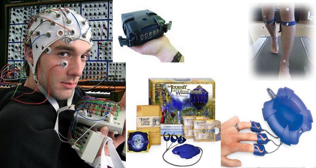 الکترو انسفالوگرام(EEG)