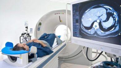 سی تی اسکن چیست؟ کاربرد، مزایا و معایب CT Scan 31 سی تی اسکن